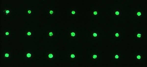 Zell-Gel-Tropfen direkt nach dem Druck mit einem 3D-Bioloaserdrucker (unter dem Fluoreszenzmikroskop). Foto: Dr. Lothar Koch