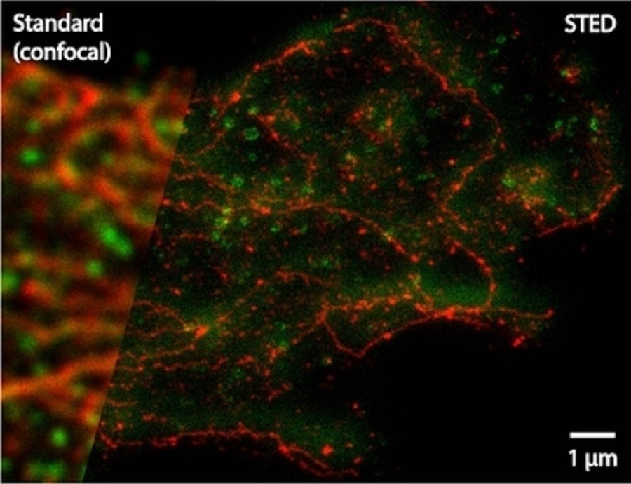 Zwei-Farben-STED-Aufnahme eines Glioblastoms, des häufigsten bösartigen Hirntumors bei Erwachsenen. Das Protein Clathrin ist grün, das Protein β-Tubulin rot angefärbt. Im Gegensatz zum verschwommenen klassischen Bild (links) zeigt das STED-Bild (rechts) erheblich feinere Strukturen. © J. Bückers, D. Wildanger, L. Kastrup, R. Medda; Max-Planck-Institut für biophysikalische Chemie 